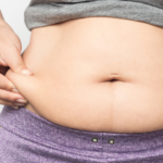 Weight Loss Pills in Combating Obesity
